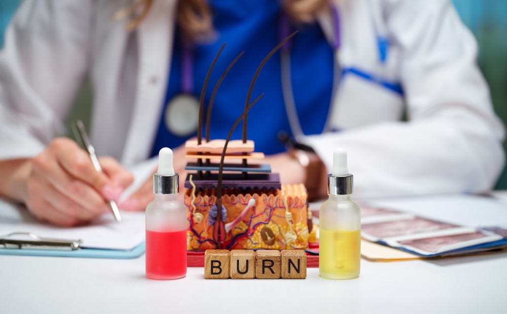 Doctor reviewing burn injury treatment plan with skin model and vials, representing medical care and legal claims for negligent burn injuries.